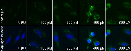  ab28 staining p53 in HeLa cells treated with genipin (ab141049), by ICC/IF. Increase of p53 expression correlates with increased concentration of genipin, as described in literature.The cells were incubated at 37°C for 6h in media containing different concentrations of ab141049 (genipin) in DMSO, fixed with 4% formaldehyde for 10 minutes at room temperature and blocked with PBS containing 10% goat serum, 0.3 M glycine, 1% BSA and 0.1% tween for 2h at room temperature. Staining of the treated cells with ab28 (5 µg/ml) was performed overnight at 4°C in PBS containing 1% BSA and 0.1% tween. A DyLight 488 anti-mouse polyclonal antibody (ab96879) at 1/250 dilution was used as the secondary antibody. Nuclei were counterstained with DAPI and are shown in blue.