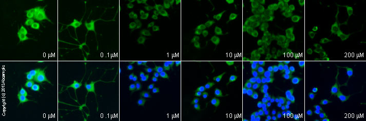  ab6427 staining dopamine in PC12 cells treated with ghrelin (rat) (ab120231), by ICC/IF. Decrease in dopamine expression correlates with increased concentration of ghrelin, as described in literature.The cells were incubated at 37°C for 10 minutes in media containing different concentrations of ab120231 (ghrelin) in DMSO, fixed with 100% methanol for 5 minutes at -20°C and blocked with PBS containing 10% goat serum, 0.3 M glycine, 1% BSA and 0.1% tween for 2h at room temperature. Staining of the treated cells with ab6427 (1/200 dilution) was performed overnight at 4°C in PBS containing 1% BSA and 0.1% tween. A DyLight 488 goat anti-rabbit polyclonal antibody (ab96899) at 1/250 dilution was used as the secondary antibody. Nuclei were counterstained with DAPI and are shown in blue.