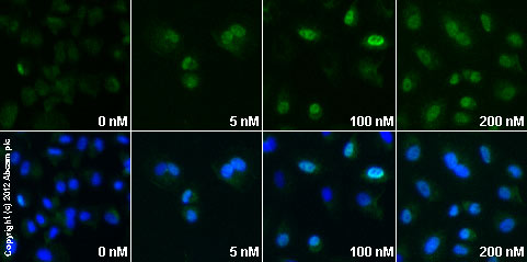  ab58668 staining ATF3 in A549 cells treated with ionomycin (free acid) (ab120370), by ICC/IF. Increase in ATF3 expression correlates with increased concentration of ionomycin (free acid), as described in literature.The cells were incubated at 37°C for 2h in media containing different concentrations of ab120370 (Ionomycin (free acid)) in DMSO, fixed with 4% formaldehyde for 10 minutes at room temperature and blocked with PBS containing 10% goat serum, 0.3 M glycine, 1% BSA and 0.1% tween for 2h at room temperature. Staining of the treated cells with ab58668 (10 µg/ml) was performed overnight at 4°C in PBS containing 1% BSA and 0.1% tween. A DyLight 488 goat anti-mouse polyclonal antibody (ab96879) at 1/250 dilution was used as the secondary antibody. Nuclei were counterstained with DAPI and are shown in blue.