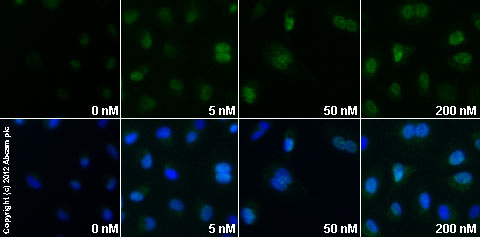  ab58668 staining ATF3 in A549 cells treated with ionomycin Ca2+ salt (ab120116), by ICC/IF. Increase in ATF3 expression correlates with increased concentration of ionomycin Ca2+ salt, as described in literature.The cells were incubated at 37°C for 2h in media containing different concentrations of ab120116 (ionomycin Ca2+ salt) in DMSO, fixed with 4% formaldehyde for 10 minutes at room temperature and blocked with PBS containing 10% goat serum, 0.3 M glycine, 1% BSA and 0.1% tween for 2h at room temperature. Staining of the treated cells with ab58668 (10 µg/ml) was performed overnight at 4°C in PBS containing 1% BSA and 0.1% tween. A DyLight 488 goat anti-mouse polyclonal antibody (ab96879) at 1/250 dilution was used as the secondary antibody. Nuclei were counterstained with DAPI and are shown in blue.