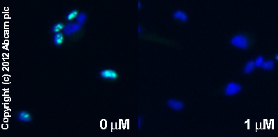  ab15580  staining Ki67 in SK-N-SH cells treated with NADA (N-Arachidonyldopamine) (ab120099), by ICC/IF. Decrease in Ki67 expression correlates with increased concentration of NADA (N-Arachidonyldopamine), as described in literature.The cells were incubated at 37°C for 10 minutes in media containing different concentrations of ab120099 (NADA (N-Arachidonyldopamine)) in ethanol, fixed with 4% formaldehyde for 10 minutes at room temperature and blocked with PBS containing 10% goat serum, 0.3 M glycine, 1% BSA and 0.1% tween for 2h at room temperature. Staining of the treated cells with ab15580 (1 µg/ml) was performed overnight at 4°C in PBS containing 1% BSA and 0.1% tween. A DyLight 488 goat anti-rabbit polyclonal antibody (ab96899) at 1/250 dilution was used as the secondary antibody. Nuclei were counterstained with DAPI and are shown in blue.