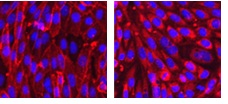  Left: ab118177 ligand (100 nM) binding to live CHO cells expressing serotonergic 5-HT1A receptors. Right: Binding blocked by the unlabelled competitor WAY-100635 (10 µM). Nuclei have been counter-stained with Hoechst.