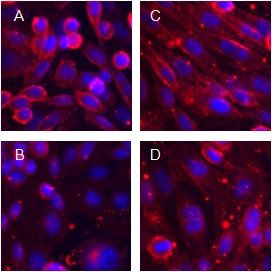  ab118167 ligand binding and displacement. Top (A,C): ab118167 ligand (100 nm) binding to two different live cell lines expressing β1 (A) or β2 (C) adrenoceptors. Bottom (B, D): Binding blocked in the same cell lines β1 (B) or β2 (D) by the unlabelled competitor ICI118551 (1 µM). Nuclei have been counter-stained with Hoechst.