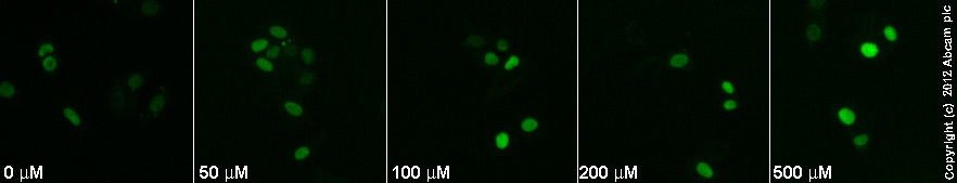  ab32034  staining p27 KIP1 in MCF7 cells treated with NS 398 (ab120295), by ICC/IF. Increase in p27 KIP1 expression correlates with increased concentration of NS 398, as described in literature.The cells were incubated at 37°C for 6h in media containing different concentrations of ab120295 (NS 398) in DMSO, fixed with 4% formaldehyde for 10 minutes at room temperature and blocked with PBS containing 10% goat serum, 0.3 M glycine, 1% BSA and 0.1% tween for 2h at room temperature. Staining of the treated cells with ab32034 (1/100 dilution) was performed overnight at 4°C in PBS containing 1% BSA and 0.1% tween. A DyLight 488 goat anti-rabbit polyclonal antibody (ab96899) at 1/250 dilution was used as the secondary antibody.