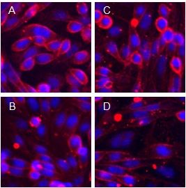  ab118170 ligand binding and displacement. Top (a, C): ab118170 binding to two different live cell lines expressing β1 (A) or β2 (C) adrenoceptors. Bottom (B, D): Binding blocked in the same two cell lines β1 (B) or β2 (D) by the unlabelled competitor ICI118551 (1 µM). Nuclei have been counter-stained with Hoechst.
