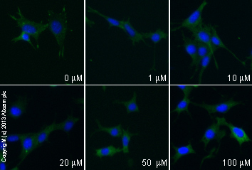  ab32084 staining paxillin in MEF1 cells treated with (+/-)-blebbistatin (ab120425), by ICC/IF. Decreased membrane expression of paxillin correlates with increased concentration of (+/-)-blebbistatin, as described in literature.The cells were incubated at 37°C for 1h in media containing different concentrations of ab120425 ((+/-)-blebbistatin) in DMSO, fixed with 4% formaldehyde for 10 minutes at room temperature and blocked with PBS containing 10% goat serum, 0.3 M glycine, 1% BSA and 0.1% tween for 2h at room temperature. Staining of the treated cells with ab32084 (1/100 dilution) was performed overnight at 4°C in PBS containing 1% BSA and 0.1% tween. A DyLight 488 goat anti-rabbit polyclonal antibody (ab96899) at 1/250 dilution was used as the secondary antibody. Nuclei were counterstained with DAPI and are shown in blue.