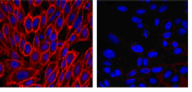  Left: ab118175 ligand (30 nM) binding to CHO cells expressing histamine H2 receptors. Right: Binding blocked by the unlabelled competitor ranitidine (10 µM). Nuclei have been counter-stained with Hoechst.