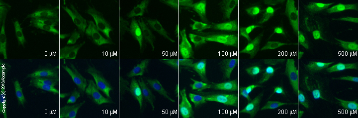  ab17722 staining FMRP in SK-N-SH cells treated with (R,S)-3,5-DHPG (ab120020), by ICC/IF. Increase in FMRP expression correlates with increased concentration of (R,S)-3,5-DHPG, as described in literature.The cells were incubated at 37°C for 1h in media containing different concentrations of ab120020 ((R,S)-3,5-DHPG) in DMSO, fixed with 4% formaldehyde for 10 minutes at room temperature and blocked with PBS containing 10% goat serum, 0.3 M glycine, 1% BSA and 0.1% tween for 2h at room temperature. Staining of the treated cells with ab17722 (5 µg/ml) was performed overnight at 4°C in PBS containing 1% BSA and 0.1% tween. A DyLight 488 goat anti-rabbit polyclonal antibody (ab96899) at 1/250 dilution was used as the secondary antibody. Nuclei were counterstained with DAPI and are shown in blue.