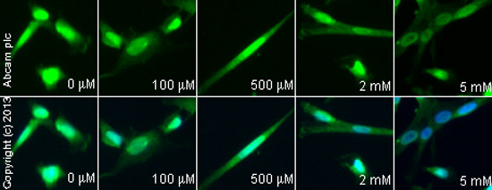  ab17722 staining FMRP in SK-N-SH cells treated with (R,S)-MCPG sodium salt (ab120252), by ICC/IF. Decrease of FMRP expression correlates with increased concentration of (R,S)-MCPG sodium salt, as described in literature.The cells were incubated at 37°C for 2h in media containing different concentrations of ab120252 ((R,S)-MCPG sodium salt) in DMSO, fixed with 4% formaldehyde for 10 minutes at room temperature and blocked with PBS containing 10% goat serum, 0.3 M glycine, 1% BSA and 0.1% tween for 2h at room temperature. Staining of the treated cells with ab17722 (5 µg/ml) was performed overnight at 4°C in PBS containing 1% BSA and 0.1% tween. A DyLight 488 anti-rabbit polyclonal antibody (ab96899) at 1/250 dilution was used as the secondary antibody. Nuclei were counterstained with DAPI and are shown in blue.