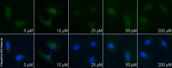  ab85555 staining PKM2 in HeLa cells treated with resveratrol (ab120726), by ICC/IF. Decrease in PKM2 expression correlates with increased concentration of resveratrol as described in literature.The cells were incubated at 37°C for 48h in media containing different concentrations of ab120726 (resveratrol) in DMSO, fixed with 4% formaldehyde for 10 minutes at room temperature and blocked with PBS containing 10% goat serum, 0.3 M glycine, 1% BSA and 0.1% tween for 2h at room temperature. Staining of the treated cells with ab85555 (5 µg/ml) was performed overnight at 4°C in PBS containing 1% BSA and 0.1% tween. A DyLight 488 goat anti-rabbit polyclonal antibody (ab96899) at 1/250 dilution was used as the secondary antibody. Nuclei were counterstained with DAPI and are shown in blue.