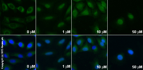  ab3580 staining glucocorticoid receptor in serum starved HeLa cells treated with rosiglitazone (120762), by ICC/IF. Changes in localization of glucocorticoid receptor (translocation from cytoplasm to nucleous) correlates with increased concentration of rosiglitazone, as described in literature.The cells were incubated at 37°C for 1h in media containing different concentrations of ab120762 (rosiglitazone) in DMSO, fixed with 4% formaldehyde for 10 minutes at room temperature and blocked with PBS containing 10% goat serum, 0.3 M glycine, 1% BSA and 0.1% tween for 2h at room temperature. Staining of the treated cells with ab3580 (5 µg/ml) was performed overnight at 4°C in PBS containing 1% BSA and 0.1% tween. A DyLight 488 goat anti-rabbit polyclonal antibody (ab96899) at 1/250 dilution was used as the secondary antibody. Nuclei were counterstained with DAPI and are shown in blue.