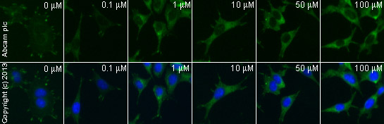  ab32084 staining paxillin in MEF1 cells treated with (S)-(-)-Blebbistatin (ab120491), by ICC/IF. Decreased membrane expression of paxillin correlates with increased concentration of (S)-(-)-Blebbistatin , as described in literature.The cells were incubated at 37°C for 2h in media containing different concentrations of ab120491 ( (S)-(-)-Blebbistatin ) in DMSO, fixed with 4% formaldehyde for 10 minutes at room temperature and blocked with PBS containing 10% goat serum, 0.3 M glycine, 1% BSA and 0.1% tween for 2h at room temperature. Staining of the treated cells with ab32084 (1/100 dilution) was performed overnight at 4°C in PBS containing 1% BSA and 0.1% tween. A DyLight 488 goat anti-rabbit polyclonal antibody (ab96899) at 1/250 dilution was used as the secondary antibody. Nuclei were counterstained with DAPI and are shown in blue.