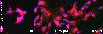  ab81298  staining FAK (phospho Y397) in SK-N-SH cells treated with anandamide (ethanol solution) (ab120087), by ICC/IF. Increase in FAK (phospho Y397) expression correlates with increased concentration of anandamide (ethanol solution), as described in literature.The cells were incubated at 37°C for 10 minutes in media containing different concentrations of ab120087 (anandamide (ethanol solution)) in ethanol, fixed with 100% methanol for 5 minutes at -20°C and blocked with PBS containing 10% goat serum, 0.3 M glycine, 1% BSA and 0.1% tween for 2h at room temperature. Staining of the treated cells with ab81298 (5 µg/ml) was performed overnight at 4°C in PBS containing 1% BSA and 0.1% tween. A DyLight 488 goat anti-rabbit polyclonal antibody (ab96899) at 1/250 dilution was used as the secondary antibody. Nuclei were counterstained with DAPI and are shown in blue. Membranes are stained in red with WGA.