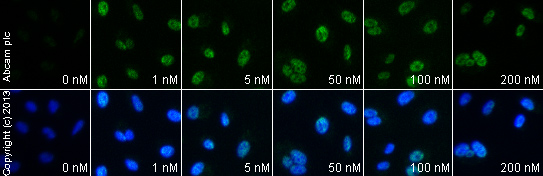  ab58668 staining ATF3 in serum starved A549 cells treated with thapsigargin (ab120286), by ICC/IF. Increase of ATF3 correlates with increased concentration of thapsigargin, as described in literature.The cells were incubated at 37°C for 1h in media containing different concentrations of ab120286 (thapsigargin) in DMSO, fixed with 4% formaldehyde for 10 minutes at room temperature and blocked with PBS containing 10% goat serum, 0.3 M glycine, 1% BSA and 0.1% tween for 2h at room temperature. Staining of the treated cells with ab58668 (10 µg/ml) was performed overnight at 4°C in PBS containing 1% BSA and 0.1% tween. A DyLight 488 goat anti-mouse polyclonal antibody (ab96879) at 1/250 dilution was used as the secondary antibody. Nuclei were counterstained with DAPI and are shown in blue.