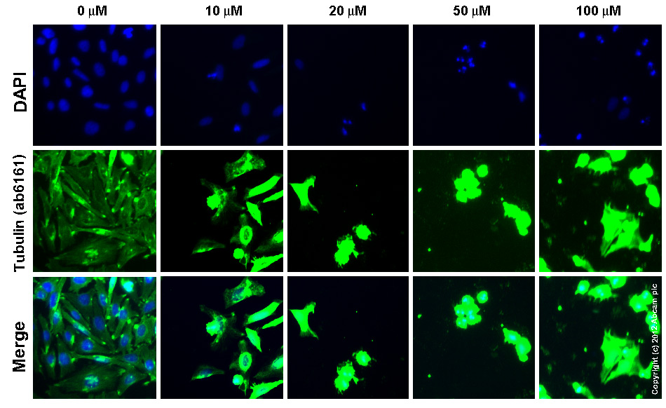  ab6161 staining tubulin HeLa cells treated with anisomycin (ab120495), by ICC/IF. Increase in tubulin expression correlates with increased concentration of anisomycin as described in literature.The cells were incubated at 37°C for 6h in media containing different concentrations of ab120495 (anisomycin) in DMSO, fixed with 4% formaldehyde for 10 minutes at room temperature and blocked with PBS containing 10% goat serum, 0.3 M glycine, 1% BSA and 0.1% tween for 2h at room temperature. Staining of the treated cells with ab6161 (5 µg/ml) was performed overnight at 4°C in PBS containing 1% BSA and 0.1% tween. A DyLight 488 goat anti-rat polyclonal antibody (ab98386) at 1/250 dilution was used as the secondary antibody. Nuclei were counterstained with DAPI and are shown in blue.