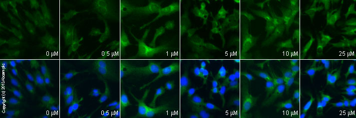  ab66705 staining PAI1 in HepG2 cells treated with BAPTA-AM (ab120503), by ICC/IF. Increase in PAI1 expression correlates with increased concentration of BAPTA-AM, as described in literature.The cells were incubated at 37°C for 4 hours in media containing different concentrations of ab120503 (BAPTA-AM) in DMSO, fixed with 100% methanol for 5 minutes at -20°C and blocked with PBS containing 10% goat serum, 0.3 M glycine, 1% BSA and 0.1% tween for 2h at room temperature. Staining of the treated cells with ab66705 (5 µg/ml) was performed overnight at 4°C in PBS containing 1% BSA and 0.1% tween. A DyLight 488 goat anti-rabbit polyclonal antibody (ab96899) at 1/250 dilution was used as the secondary antibody. Nuclei were counterstained with DAPI and are shown in blue.