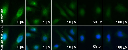  ab18210 staining Bcl2 in HeLa cells treated with bisdemethoxycurcumin (ab120976), by ICC/IF. Decrease of Bcl2 expression correlates with increased concentration of bisdemethoxycurcumin, as described in literature.The cells were incubated at 37°C for 6 hours in media containing different concentrations of ab120976 (bisdemethoxycurcumin) in DMSO, fixed with 100% methanol for 5 minutes at -20°C and blocked with PBS containing 10% goat serum, 0.3 M glycine, 1% BSA and 0.1% tween for 2h at room temperature. Staining of the treated cells with ab18209 (5 µg/ml) was performed overnight at 4°C in PBS containing 1% BSA and 0.1% tween. A DyLight 488 anti-rabbit polyclonal antibody (ab96899) at 1/250 dilution was used as the secondary antibody. Nuclei were counterstained with DAPI and are shown in blue.