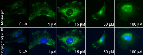  ab48394 staining LC3B (LC3-II) in HeLa cells treated with calmidazolium chloride (ab120658), by ICC/IF. Increase of LC3B (LC3-II) expression correlates with increased concentration of calmidazolium chloride, as described in literature.The cells were incubated at 37°C for 6h in media containing different concentrations of ab120658 (calmidazolium chloride) in DMSO, fixed with 4% formaldehyde for 10 minutes at room temperature and blocked with PBS containing 10% goat serum, 0.3 M glycine, 1% BSA and 0.1% tween for 2h at room temperature. Staining of the treated cells with ab48394 (1 µg/ml) was performed overnight at 4°C in PBS containing 1% BSA and 0.1% tween. A DyLight 488 anti-rabbit polyclonal antibody (ab96899) at 1/250 dilution was used as the secondary antibody. Nuclei were counterstained with DAPI and are shown in blue.