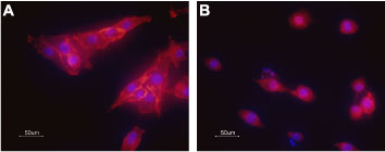  Cytochalasin E inhibits actin polymerization in C6 glioma cells. Cells were incubated in the absence (A) or presence (B) of 10 µM Cytochalasin E (ab141788) for 1 h at 37°C. The figure shows dual staining using Rhodamine-conjugated-Palloidine (red, for actin filament staining) and DAPI for nucleus staining (blue).