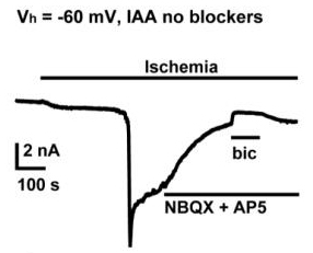  Representative voltage-clamp recording (Vh= −60 mV, ECl−=+8 mV) of a Purkinje cells response to simulated ischemia and sequential block of glutamate receptors and GABAA receptors.
