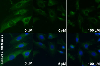  ab38511 staining βcatenin (phospho Thr42 + Ser45) in SK-N-SH cells treated with D4476 (ab120220), by ICC/IF. Decrease in expression of βcatenin (phospho Thr42 + Ser45) correlates with increased concentration of D4476, as described in literature.The cells were incubated at 37°C for 2h in media containing different concentrations of ab120220 (D4476) in DMSO, fixed with 4% formaldehyde for 10 minutes at room temperature and blocked with PBS containing 10% goat serum, 0.3 M glycine, 1% BSA and 0.1% tween for 2h at room temperature. Staining of the treated cells with ab38511 (5 µg/ml) was performed overnight at 4°C in PBS containing 1% BSA and 0.1% tween. A DyLight 488 goat anti-rabbit polyclonal antibody (ab96899) at 1/250 dilution was used as the secondary antibody. Nuclei were counterstained with DAPI and are shown in blue.