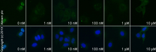  ab81283 staining AKT1 (phospho S473) in MCF7 cells treated with DAPT (ab120633), by ICC/IF. Decrease in expression of AKT1 (phospho S473) correlates with increased concentration of DAPT, as described in literature.The cells were incubated at 37°C for 24h in media containing different concentrations of ab120633 (DAPT) in DMSO, fixed with 4% formaldehyde for 10 minutes at room temperature and blocked with PBS containing 10% goat serum, 0.3 M glycine, 1% BSA and 0.1% tween for 2h at room temperature. Staining of the treated cells with ab81283 (1/200 dilution) was performed overnight at 4°C in PBS containing 1% BSA and 0.1% tween. A DyLight 488 goat anti-rabbit polyclonal antibody (ab96899) at 1/250 dilution was used as the secondary antibody. Nuclei were counterstained with DAPI and are shown in blue.