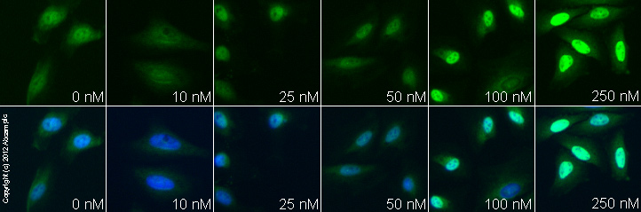 ab75974 staining p57 Kip2 in HeLa cells treated with dexamethasone (ab120743), by ICC/IF. Increase in p57 Kip2 expression correlates with increased concentration of dexamethasone as described in literature.The cells were incubated at 37°C for 24h in media containing different concentrations of ab120743 (dexamethasone) in DMSO, fixed with 4% formaldehyde for 10 minutes at room temperature and blocked with PBS containing 10% goat serum, 0.3 M glycine, 1% BSA and 0.1% tween for 2h at room temperature. Staining of the treated cells with ab75974 (5 µg/ml) was performed overnight at 4°C in PBS containing 1% BSA and 0.1% tween. A DyLight 488 goat anti-rabbit polyclonal antibody (ab96899) at 1/250 dilution was used as the secondary antibody. Nuclei were counterstained with DAPI and are shown in blue.