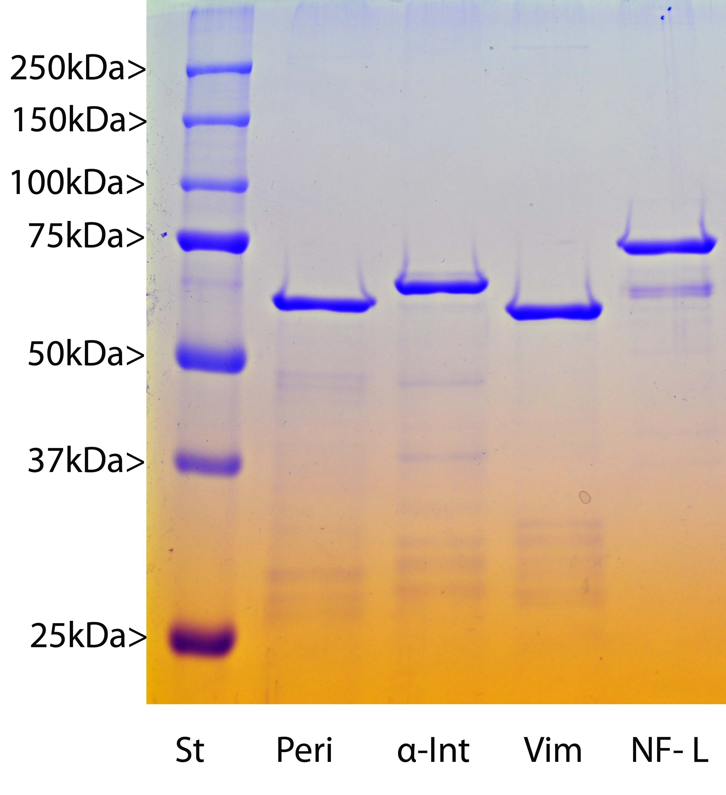 Image: Coomassie Brilliant Blue stained SDS-PAGE gel of various recombinant proteins. His-tagged human Neurofilament NF-L, was expressed and purified from E. coli BL21 using immobilized metal affinity chromatography. 1µg of protein was run on each lane, and the lane indicated with "NF-L" contains the Neurofilament NF-L protein. The other lanes show recombinant His-tagged Peripherin, α-Internexin and Vimentin as indicated. Protein molecular weight standards are in the first lane and apparent molecular weights are as indicated.