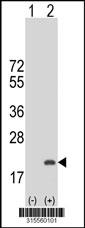 Western blot analysis of his-tag CNIH2 (arrow) using his tag antibody. 293 cell lysates (2 ug/lane) either nontransfected (Lane 2) or transiently transfected with theCNIH2 gene
