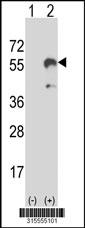 Western blot analysis of his-tag CADM1 (arrow) using his tag antibody. 293 cell lysates (2 ug/lane) either nontransfected (Lane 2) or transiently transfected with theCADM1 gene