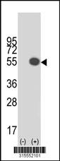 Western blot analysis of his-tag LEF1 (arrow) using his tag antibody. 293 cell lysates (2 ug/lane) either nontransfected (Lane 2) or transiently transfected with theLEF1 gene