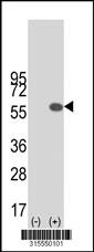 Western blot analysis of his-tag VPS4A (arrow) using his tag antibody. 293 cell lysates (2 ug/lane) either nontransfected (Lane 2) or transiently transfected with theVPS4A gene