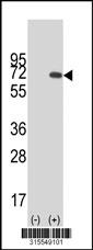 Western blot analysis of his-tag C4orf35 (arrow) using his tag antibody. 293 cell lysates (2 ug/lane) either nontransfected (Lane 2) or transiently transfected with theC4orf35 gene