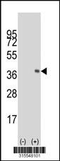 Western blot analysis of his-tag MON1A (arrow) using his tag antibody. 293 cell lysates (2 ug/lane) either nontransfected (Lane 2) or transiently transfected with theMON1A gene