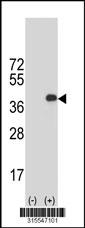 Western blot analysis of his-tag NUP35 (arrow) using his tag antibody. 293 cell lysates (2 ug/lane) either nontransfected (Lane 2) or transiently transfected with theNUP35 gene
