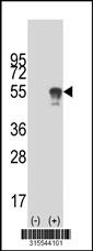Western blot analysis of his-tag EMID1 (arrow) using his tag antibody. 293 cell lysates (2 ug/lane) either nontransfected (Lane 2) or transiently transfected with theEMID1 gene