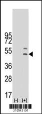 Western blot analysis of his-tag SERPINA12 (arrow) using his tag antibody. 293 cell lysates (2 ug/lane) either nontransfected (Lane 2) or transiently transfected with theSERPINA12 gene