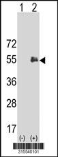Western blot analysis of his-tag DPF3 (arrow) using his tag antibody. 293 cell lysates (2 ug/lane) either nontransfected (Lane 2) or transiently transfected with theDPF3 gene