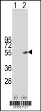 Western blot analysis of his-tag WIPI1 (arrow) using his tag antibody. 293 cell lysates (2 ug/lane) either nontransfected (Lane 2) or transiently transfected with theWIPI1 gene