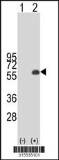 Western blot analysis of his-tag C12orf50 (arrow) using his tag antibody. 293 cell lysates (2 ug/lane) either nontransfected (Lane 2) or transiently transfected with theC12orf50 gene