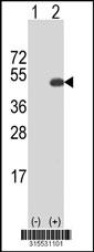 Western blot analysis of his-tag ST6GALNAC3 (arrow) using his tag antibody. 293 cell lysates (2 ug/lane) either nontransfected (Lane 2) or transiently transfected with theST6GALNAC3 gene