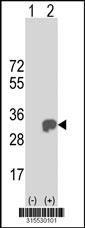 Western blot analysis of his-tag CYB5D2 (arrow) using his tag antibody. 293 cell lysates (2 ug/lane) either nontransfected (Lane 2) or transiently transfected with theCYB5D2 gene