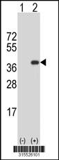 Western blot analysis of his-tag C13orf33 (arrow) using his tag antibody. 293 cell lysates (2 ug/lane) either nontransfected (Lane 2) or transiently transfected with theC13orf33 gene