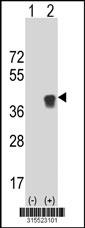Western blot analysis of his-tag C9orf150 (arrow) using his tag antibody. 293 cell lysates (2 ug/lane) either nontransfected (Lane 2) or transiently transfected with theC9orf150 gene