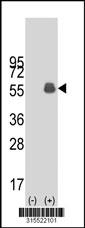 Western blot analysis of his-tag PARD6B (arrow) using his tag antibody. 293 cell lysates (2 ug/lane) either nontransfected (Lane 2) or transiently transfected with thePARD6B gene