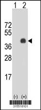 Western blot analysis of his-tag PPAP2A (arrow) using his tag antibody. 293 cell lysates (2 ug/lane) either nontransfected (Lane 2) or transiently transfected with thePPAP2A gene