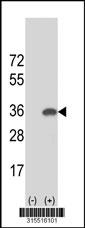 Western blot analysis of his-tag MORN3 (arrow) using his tag antibody. 293 cell lysates (2 ug/lane) either nontransfected (Lane 2) or transiently transfected with theMORN3 gene