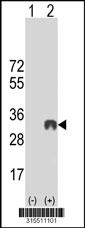 Western blot analysis of his-tag RASSF5 (arrow) using his tag antibody. 293 cell lysates (2 ug/lane) either nontransfected (Lane 2) or transiently transfected with theRASSF5 gene