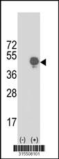 Western blot analysis of his-tag HS3ST1 (arrow) using his tag antibody. 293 cell lysates (2 ug/lane) either nontransfected (Lane 2) or transiently transfected with theHS3ST1 gene