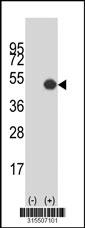 Western blot analysis of his-tag HAPLN1 (arrow) using his tag antibody. 293 cell lysates (2 ug/lane) either nontransfected (Lane 2) or transiently transfected with theHAPLN1 gene